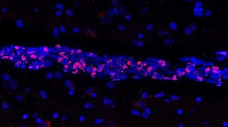 Le SARS-CoV-2 élimine certaines cellules de notre cerveau